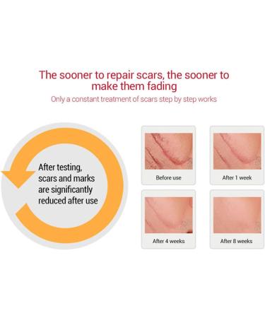  Fyearfly Scar Removal Gel 1.1 oz Scar Repair Gel Cleansing Soothing Nourishing Scars Burns Cuts Gel for Damaged Skin - Buy Online on GoSupps.com