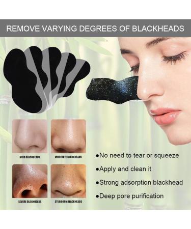 Nosestripes Blackheads Blackhead Nose Strips Deep Cleansing Clear-Up Strips 30 Pieces Nose Strips Pore Strips Anti Nose Stripes Blackheads Remove Blackheads and Impurities - Buy Online on GoSupps.com