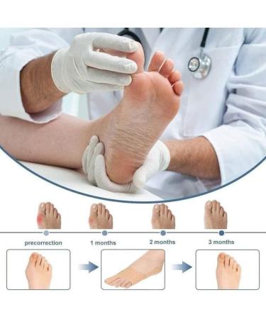 LTLCLZ Toe Separator Hallux Valgus Splint - Bunion Corrector & Pain Relief Tool for Feet - Black (Large) - Buy Online on GoSupps.com