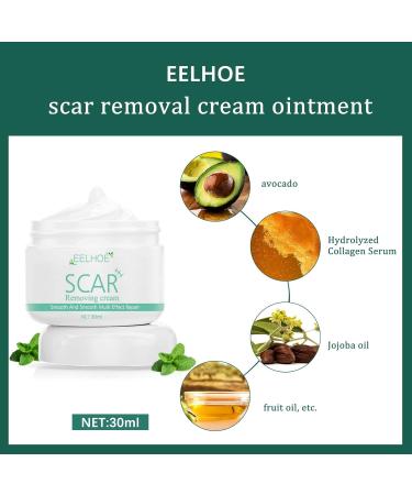 Skin Eternal Scar Removal Cream - Effective Stretch Mark and Scar Treatment for Men and Women - Great for Burns and Face Skin - One Size Fits All - Buy Online on GoSupps.com