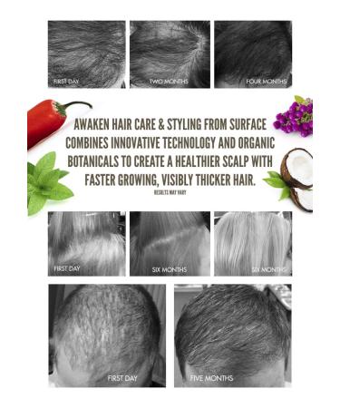 Surface Hair Healthy Scalp and Hair Thickening Shampoo - Hydrating Organic Cleanser for Thinning Hair - 10 Fl Oz - Buy Online on GoSupps.com