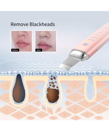 COSBEAUTY Skin Scrubber Skin Spatula | 4-in-1 Versatile Skincare Device | Exfoliating, Blackhead Remover, Moist Assistor | Wireless Charging, IPX6 Waterproof | Pink - Buy Online on GoSupps.com