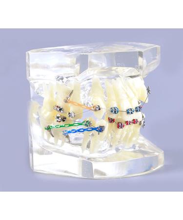 Bovdc Orthodontic Tooth Model for Malocclusion Study - Dental Education & Treatment Guide - Buy Online on GoSupps.com