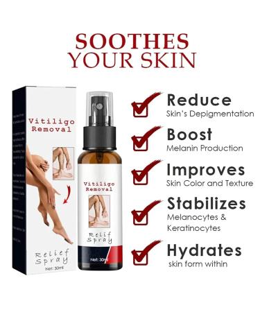 Vitiligo Removal Relief Spray - Skin Care Spray for White Spot and Vitiligo Relief (3pcs) - Buy Online on GoSupps.com