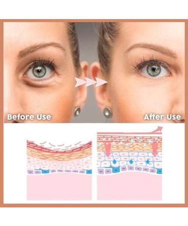 Qwedfg Eye Delight Serum - Instant Eye Bag Removal & Anti-Puffiness Cream | Reduce Wrinkles & Fine Lines in 2 Minutes - 3 Pack - Buy Online on GoSupps.com