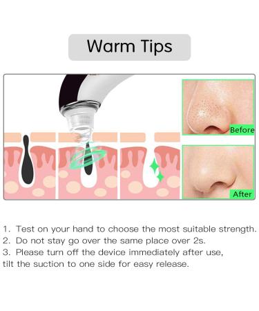 QQcute Blackhead Remover Electric Vacuum Suction Pore Cleaner - Deep Facial Skin Cleaning Beauty Device - Buy Online on GoSupps.com