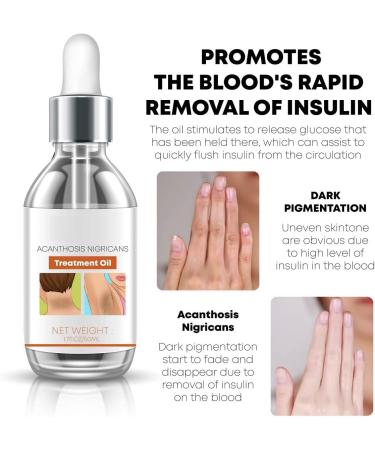  RUCRAK 2 pcs Acanthosis Nigricans Therapy Oil Dark Spot Corrector Oil Remover Lighten Body Black Skin Permanent Whitening - Buy Online on GoSupps.com