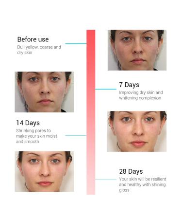 BREYLEE Rose Hydrating Face Serum with Hyaluronic Acid - Alcohol Free, 17ml - Buy Online on GoSupps.com