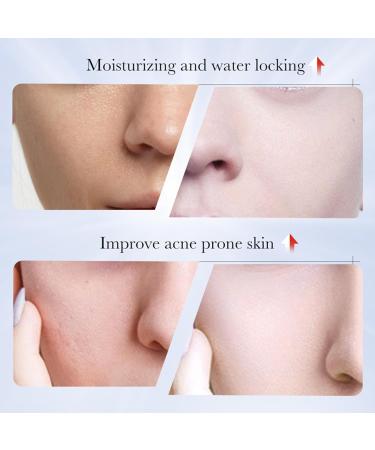  Mnozreo Kojic Acid Cream Shiny Skin Cream for Face Shiny for Dark Spots and Melanin Anti-Aging for Women 30g 1 Piece - Buy Online on GoSupps.com