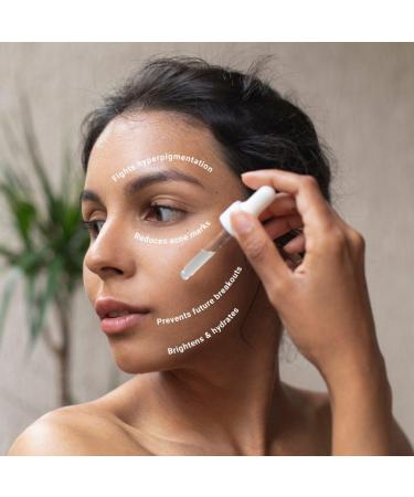 Buy Natural Vibes Ayurvedic Tea Tree Acne Repair Serum 30 ml - Reduce Acne Blemishes & Dark Spots - Buy Online on GoSupps.com