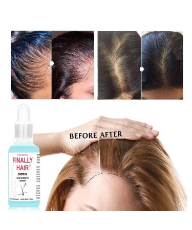 Women's Hair Loss Treatment Serum with Biotin, Collagen, and Caffeine - Promotes Hair Growth and Supports Regrowth - Buy Online on GoSupps.com