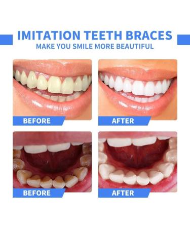 Frenzify Instant Cosmetic Tooth Veneers | Perfect Smile Snap-On Dentures | 2 Pairs - Upper & Lower - For Flawless Teeth - Buy Online on GoSupps.com