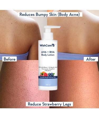 Wish'Care 0% AHA + 1% BHA Body Lotion - Smooths Rough & Bumpy Skin - Glycolic & Lactic Acid Body Lotion with Niacinamide - 200 Ml. - Buy Online on GoSupps.com