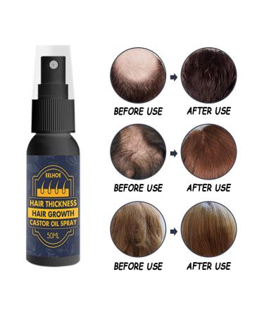 Best Hair Growth Spray & Serum | Anti-Hair Loss Treatment for Thicker Faster Hair Growth - Shop Now! - Buy Online on GoSupps.com