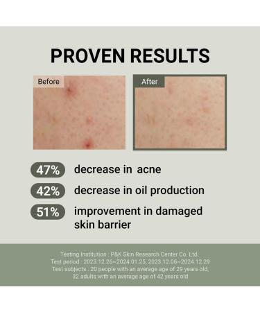 JUMISO Snail Mucin 88 + Peptide Cream 100ml | Kbeauty for Sensitive Skin Acne Relief & Oil Control - Buy Online on GoSupps.com