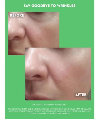 QUEEN SKIN Rejuvenating Face Serum - Anti-Aging & Wrinkle Control with Avocado Hyaluronic Acid Squalane & Peptides | 1 Fl Oz - Buy Online on GoSupps.com