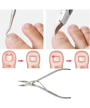 PSGS Nail Art Set 1pc Ingrown Toe Nail Correction Nipper Clipper Cutters Dead Skin Dirt Remover+Paronychia Podiatry Pedicure (Color : A) - Buy Online on GoSupps.com