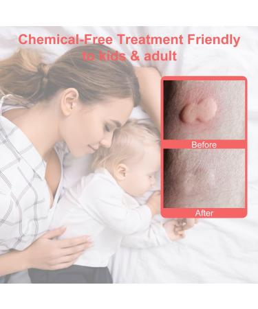 USB Electric Anti-Itch Device for Insect Bite Relief - Pink - Buy Online on GoSupps.com