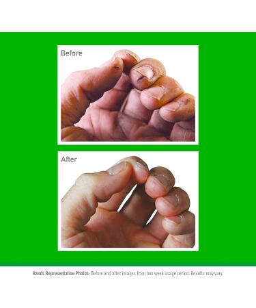 O Keeffe s Working Hands Value Tube 190ml (2 Pack) Hand Cream for Extremely Dry Cracked Hands | Non-Greasy Unscented & Instantly Boosts Moisture Levels TUBE 190 ml (Pack of 2) - Buy Online on GoSupps.com