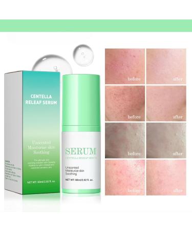 Centella Asiatica Hydrating Serum - Centella Face Serum - Face Serum for Women - Hyaluronic Acid Serum for Face - Calming & Soothing Serum Face - Buy Online on GoSupps.com