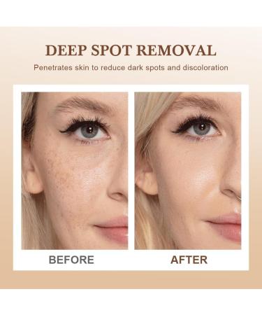  PHFTRCEW 2PCS Parowu Spot Removing Face MaskAntiBlemish & AntiAging TearOff MaskHerbal Spots PeelOff Facial MaskSuitable For Face And Body Remove Age SpotsFrecklesSun Spots - Buy Online on GoSupps.com