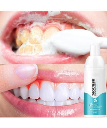 Allouli Teeth Mousse Foam Toothpaste | Teeth Whitening Stain Removal & Fresh Breath - Shop Now! - Buy Online on GoSupps.com