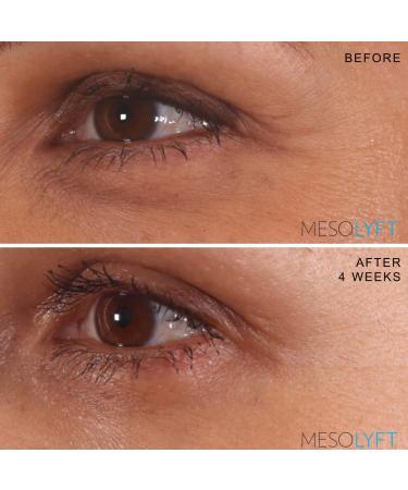 Neck & Eyes Combo Skincare Tool | Under Eye Serum & Neck Line Remover | Wrinkle Filler & Exfoliator for Firm Smooth Skin - Buy Online on GoSupps.com