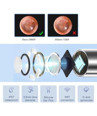 Wireless 1080P FHD Ear Wax Removal Tool Camera with LED | Smart Visual Ear Cleaner | IP67 Waterproof WiFi Otoscope for iPhone, iPad, Smart Phone | Includes 7 Ear Picks - Buy Online on GoSupps.com