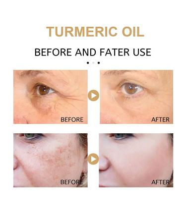 Turmeric Dark Spot Corrector Serum - Repair Face Serum for Bright Skin - Natural Moisturizing Formula - 2023 New Release (2PC-60ML) - Buy Online on GoSupps.com