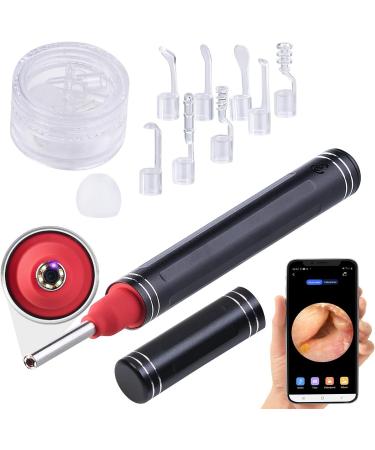 Newgen Medicals Earrkamera: WiFi Ear Cleaner with Full HD Camera Live App View & 8 Ear Tips - Ultimate Ear Health Solution - Buy Online on GoSupps.com