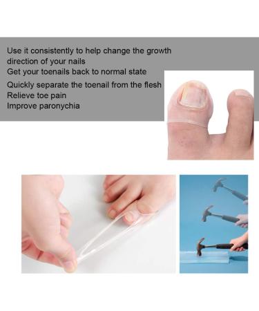 Ingrown Toenail Corrector Pain Relief Treatment Tool Made of Silicone Transparent Simple and Effective - Buy Online on GoSupps.com