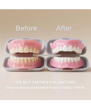 Denture & Aligner Effervescent Cleaning Tablets - 30 Count (0.17 oz Each) Deep Cleaning Antibacterial Removes Stains & Odors Safe for Dentures Retainers Night Guards & Dental Appliances - Buy Online on GoSupps.com