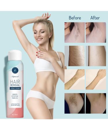 Effective & Painless Hair Removal Spray Foam for Women - Safe Depilatory Cream for Face, Arm, Leg & Armpit - Smooth, Upgraded Formula - Buy Online on GoSupps.com