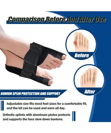 Bunion Corrector Kit - 6PCS Splint for Foot Pain Relief | Hallux Valgus Correction Day/Night Support - Women and Men - Buy Online on GoSupps.com