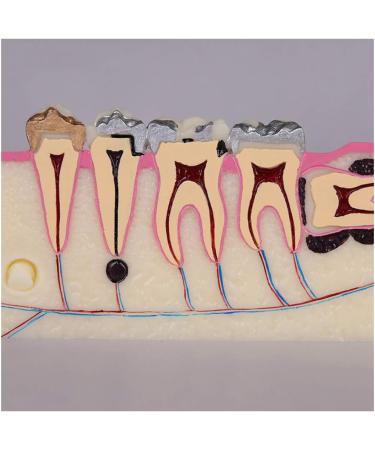 Fhuili Teeth Model for Training | Realistic Oral Tooth Demonstration & Recovery Model for Study | International Shipping - Buy Online on GoSupps.com