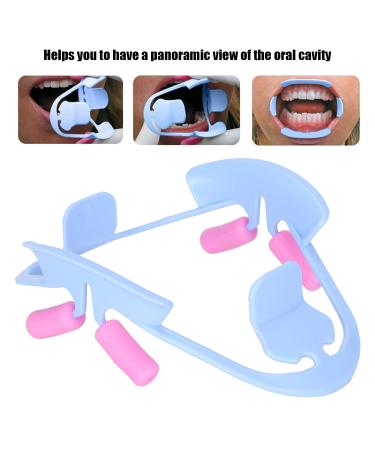 Buy Reusable 3D Oral Intraoral Cheeks Lips Retractor - Orthodontic Mouth Opener Accessories (Blue) | International Shipping - Buy Online on GoSupps.com