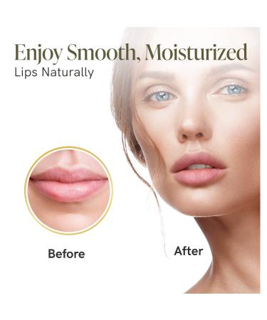 Bee Rx Lip Plumping Serum with Bee Venom & Kanuka Honey - Anti-Aging Lip Care & Moisturizer - Buy Online on GoSupps.com