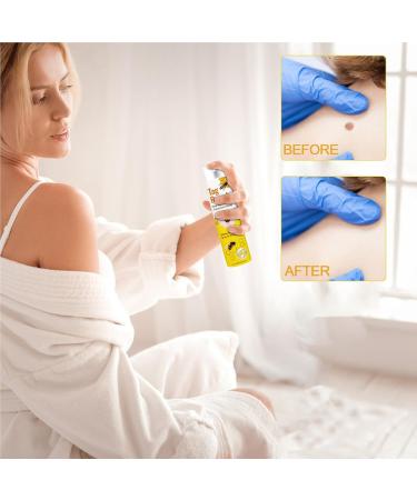 Uoqpty Wart Remover For Body Wart Remover Skin Lightening Fast Acting 20ml Natural Plant Extracts Painless For Men Women Legs Back Feet - Buy Online on GoSupps.com