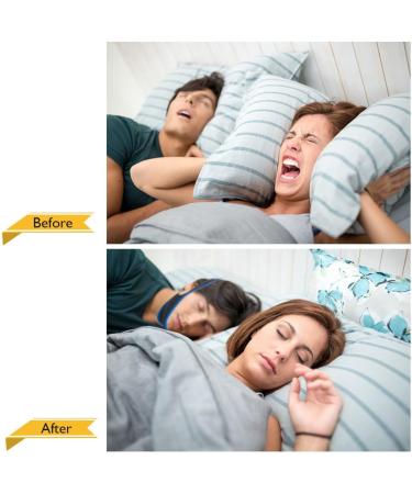 Anti Snore Chin Strap - Adjustable & Breathable Anti-Snoring Headband for Men & Women (Pink) | Shop Internationally - Buy Online on GoSupps.com