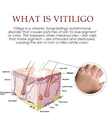 DUBUSH Vitiligo & Psoriasis Relief Spray - Skin Repair Treatment for Reducing White Spots - Soothing & Moisturizing Formula - 1 Pcs - Buy Online on GoSupps.com