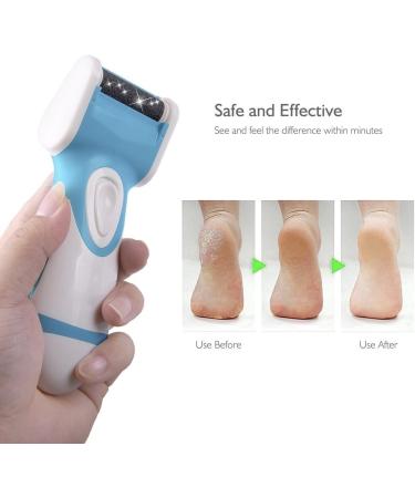 Electric Callus Remover & Foot File | Smooth Feet in Seconds | 2 Rollers Included - Shop Now - Buy Online on GoSupps.com