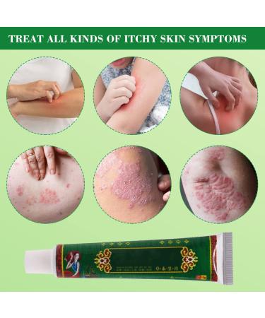 Buy Anti-Itch Cream | Herbal Antibacterial Eczema Treatment for Allergic Dermatitis - Ships Worldwide - Buy Online on GoSupps.com