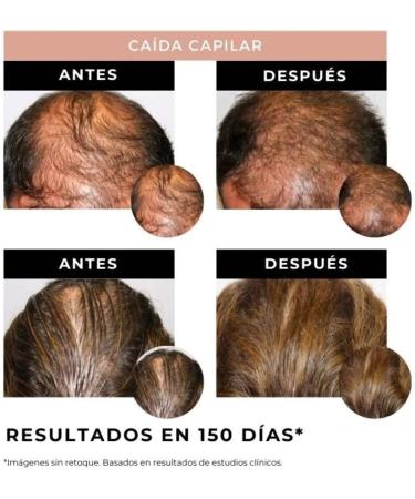 Strength Lotion Hair Growth - Buy Online on GoSupps.com