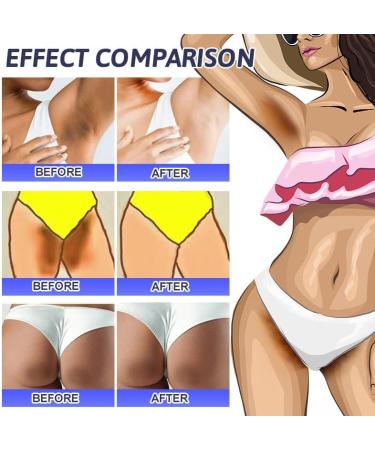 Dark Spot Remover Skin Lightening Cream Underarm Whitening Cream for Dark Skin and Private Parts - Buy Online on GoSupps.com