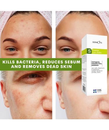 TIS Pharmaceutical TIS Sulfur 7 Cream For Oily Acne Seborrheic Skin Care Removes Skin Seborrheic Flakes Exfoliating Properties Face and Body Unisex - Buy Online on GoSupps.com