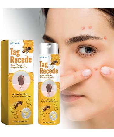 Effective Huaolawq Tag Recede Wart Removal Spray 20ml - Revitalize & Treat Warts Naturally - International Shipping Available - Buy Online on GoSupps.com
