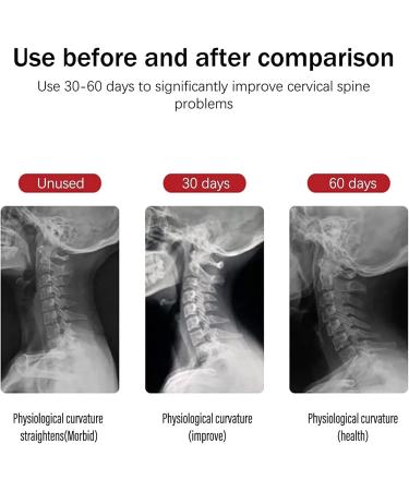 Neck Decompression Air Collar - Cervical Traction Device for Neck & Shoulder Pain Relief - Adjustable Traction Support - Buy Online on GoSupps.com