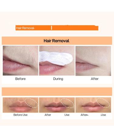  ZHJZGS Upper lip hair removal cream - Painless and gentle quick hair removal for the face and body for all skin types fast and easy (4PCS) - Buy Online on GoSupps.com