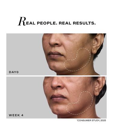 N.OVOLOGY Pro-Lift Cellular Restoration Serum Co-Created with Dermatologists 5.3% Pro-Retinol + Niacinamide + Adenosine + Tripeptide - Buy Online on GoSupps.com