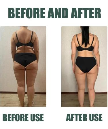 Beauty Lady Collagen Lifting Body Oil 50ML Ageless Collagen Lifting Body Oil Anti Aging Collagen Serum for Face and Body (2pcs) - Buy Online on GoSupps.com